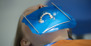Применение Коффердама в стоматологии